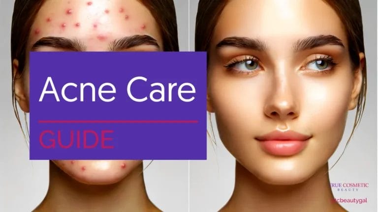 Acne Care